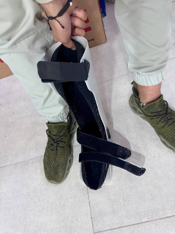 Пластиковый гипс на ногу (ортез) 2