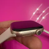 Apple Watch Series 11 3