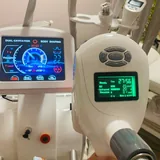 VelaShape III 2