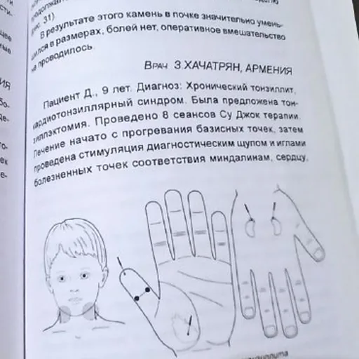 Книги, Су джок