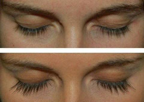 Сыворотка для роста ресниц с биматопростом 2